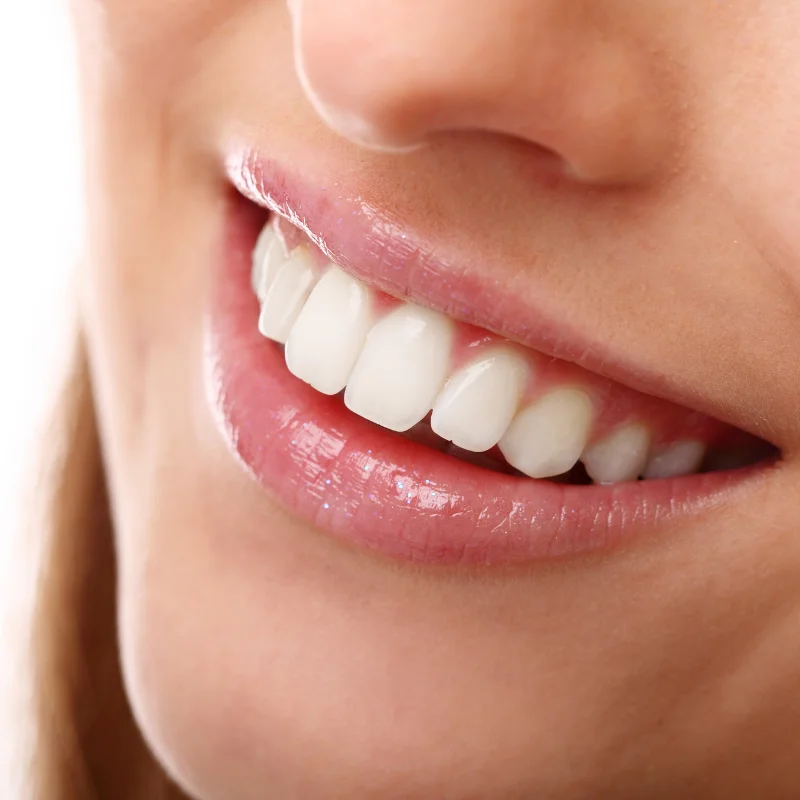 Close-up of patient's bright white smile after professional teeth whitening treatment