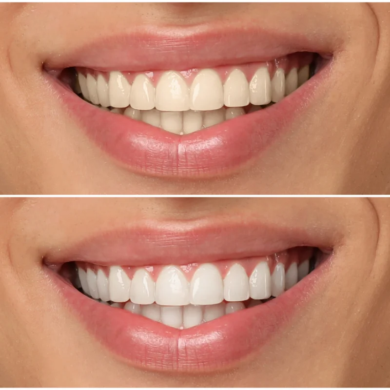 Teeth Whitening Service Waterloo at Parkside Drive Dental in Waterloo, ON