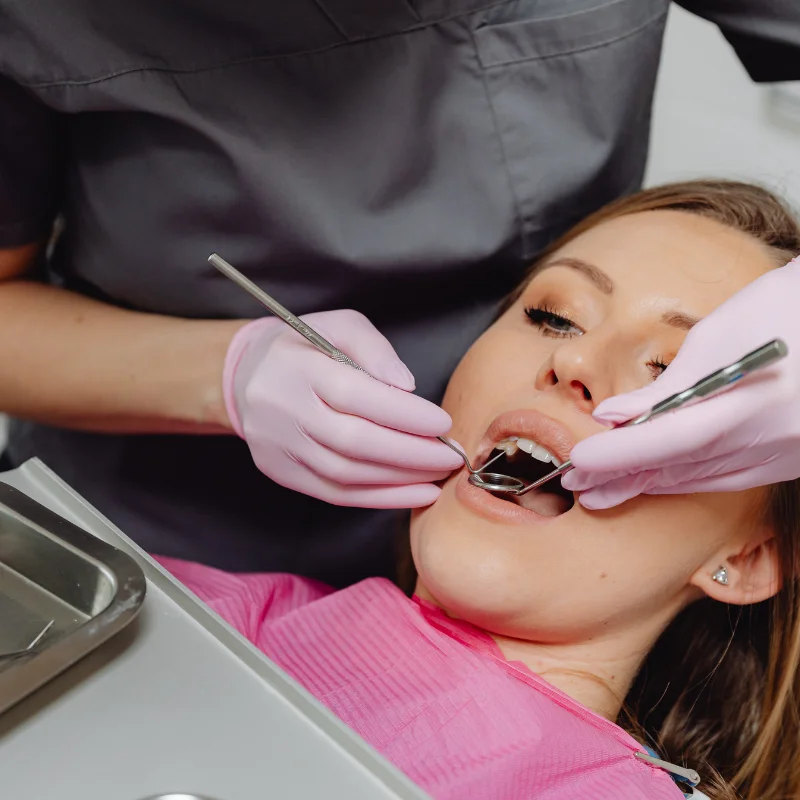 Dentist fitting and placing dental veneers on female patient's upper teeth