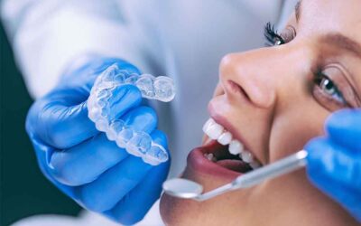 The Life-Changing Benefits of Invisalign