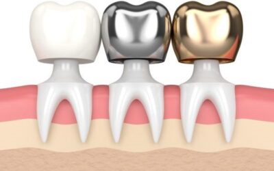 How Dental Crowns Can Enhance Your Smile