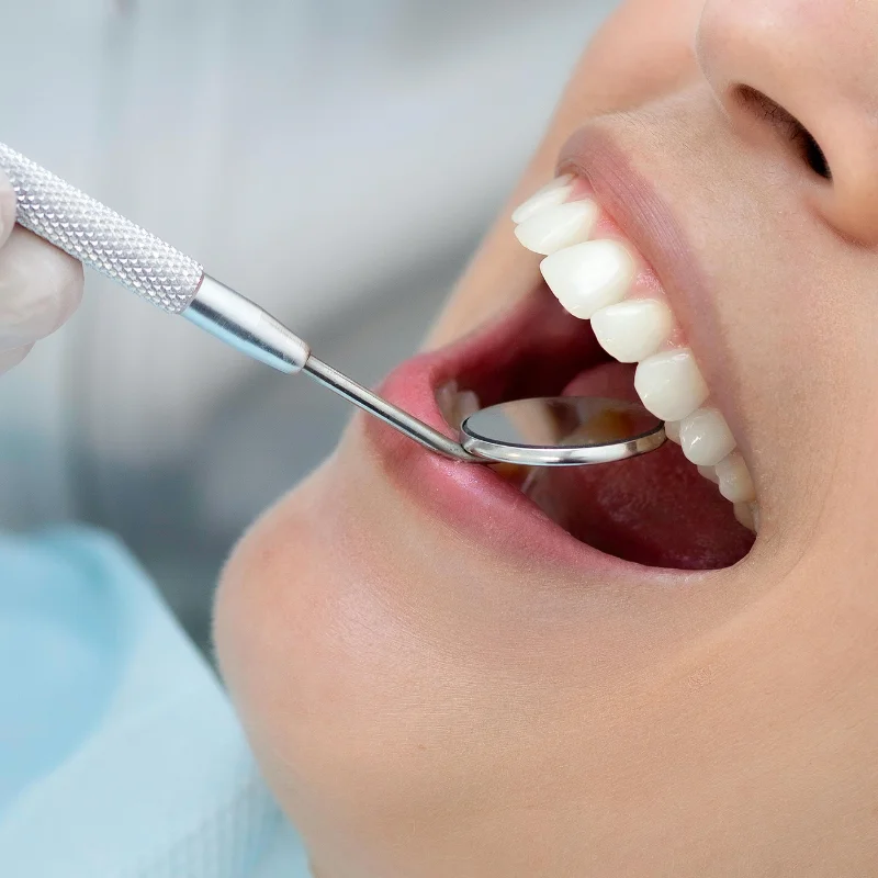 Close-up of dentist using mirror tool to examine patient's teeth during routine dental checkup