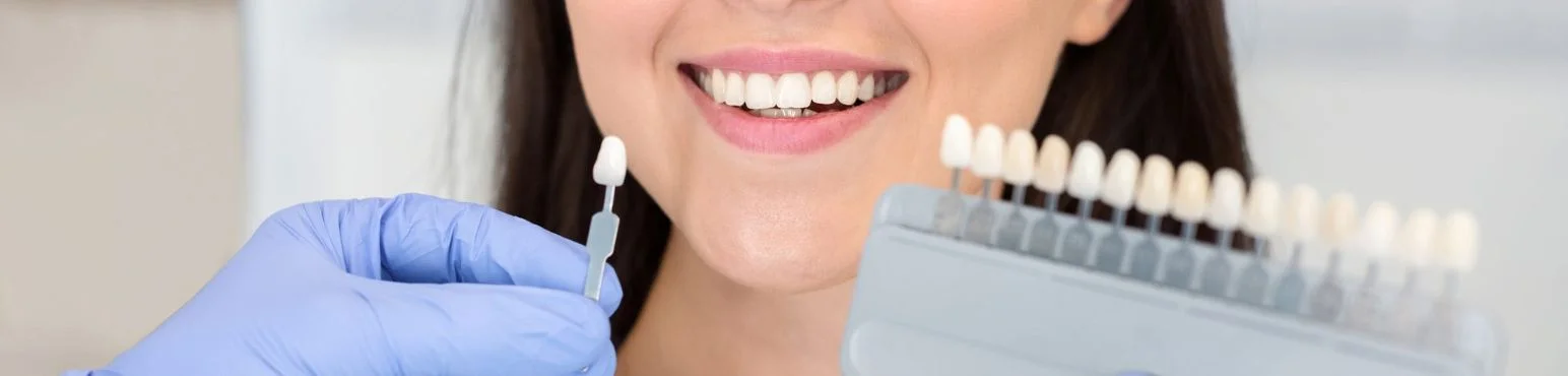 Female patient smiling while dentist selects shade guide for dental veneers at Parkside Drive Dental in Waterloo, ON